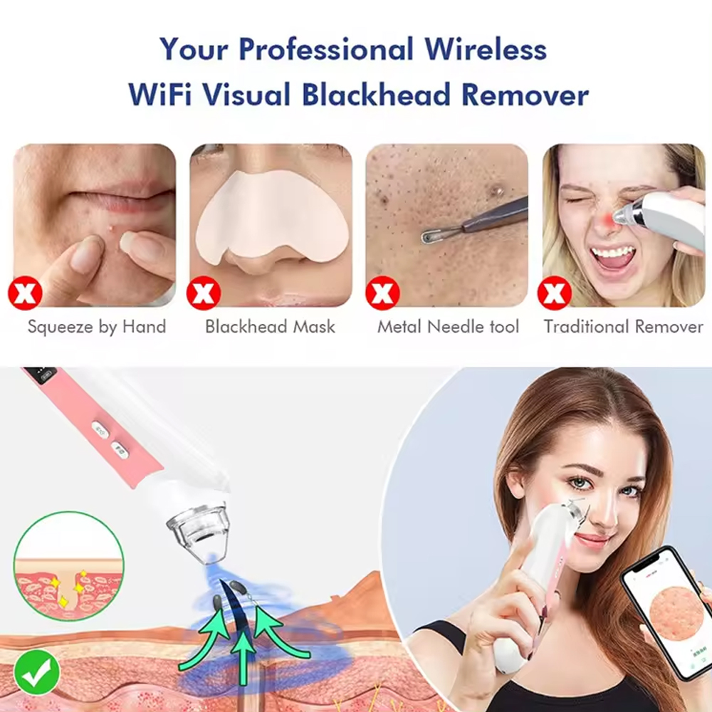 Alat perawatan kulit hidung, a - Nasal Aspirator ulasan dan harga
